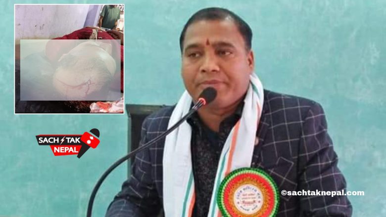जसपा नेपालका केन्द्रिय सदस्य एवंम संघीय संसदीय दलका प्रमुख साह माथि संघातीक हमला